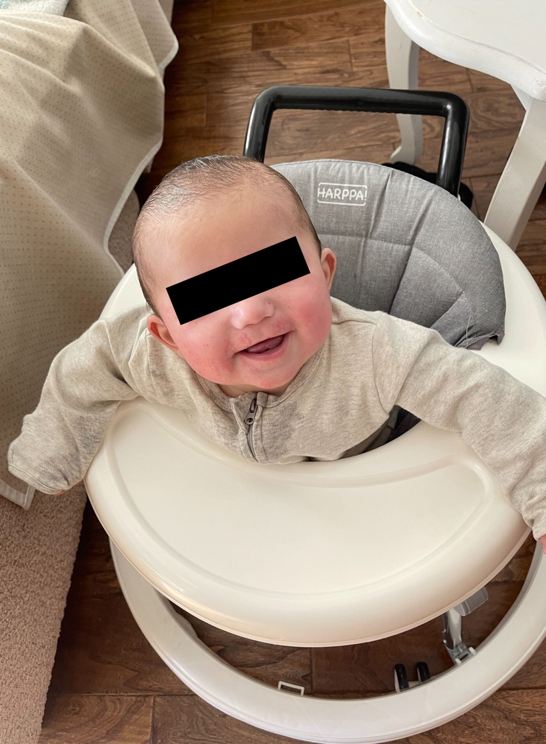 Same infant smiling with clear, healthy skin three days after removing reactive ingredients — eyes redacted for privacy